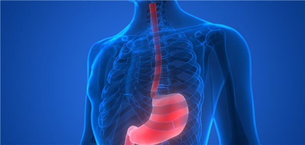 Ösophagus- und Magenkarzinome sind mit Adipositas assoziiert. Ein bariatrischer Eingriff erhöht das Risiko für diese Krebsarten jedoch nicht, so eine französische Studie.
