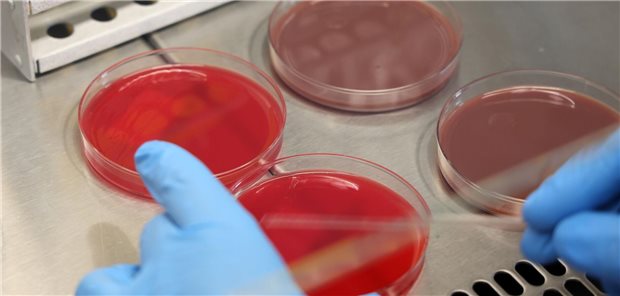 Petrischalen mit Bakterienkulturen