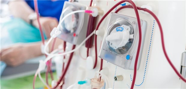 Ohne Alternative: Blutwäsche nach Nierenversagen.
