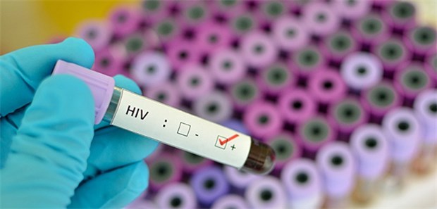 Neue Kampagne für frühe HIV-Tests Ohne HIV-Test und Diagnose bringen sich Infizierte um wirksame Therapien, die den Ausbruch von Aids verhindern.