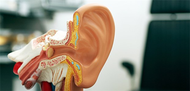 Die Ohrknöchelchen aus dem Drucker Ohrmodell: Bei einem südfarikansichen Patienten haben Ärzte gleich alle drei Knöchelchen – also Hammer (Malleus), Amboss (Incus) und Steigbügel (Stapes) – mit gedruckten Prothesen ersetzt.