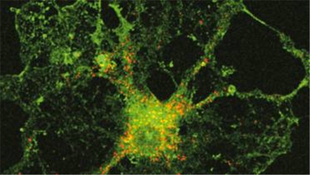 MS - nicht immer liegt's am Immunsystem Oligodendrozyt (grün) unterm Mikroskop. Fehlfunktionen solcher Zellen können zu MS führen.
