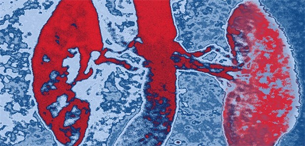Op bietet Chancen beim metastasierten Nieren-Ca.