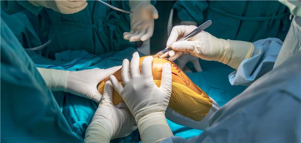 Operation zum totalen Kniegelenkersatz (Knie-TEP): Betroffene haben in der Regel postoperativ erhebliche Schmerzen.