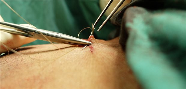 Operationen führen häufig zu einem Vitamin-C-Mangel, der wiederum das Risiko für postoperative Komplikationen erhöhen kann. 