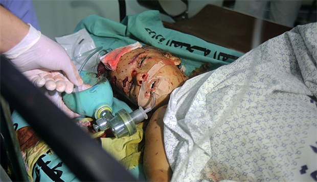 Gazas Gesundheitswesen vor dem Kollaps Opfer eines Kriegs: Verletztes Kind am Samstag im Schifa-Krankenhaus in Gaza.