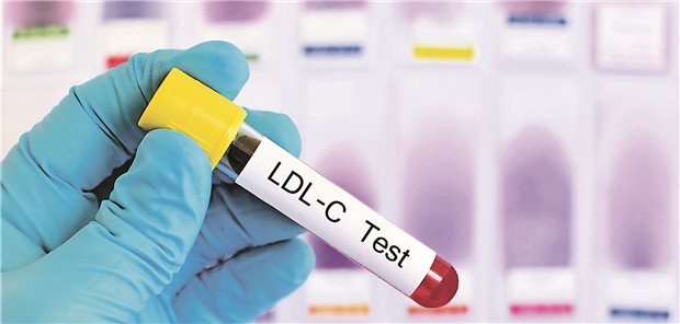 Orale Tabletten-Einnahme: Zur Lipidsenkung werden zukünftig wohl vermehrt orale Dreifachkombinationen zum Einsatz kommen, vermuten Experten.