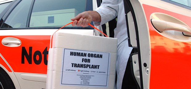 Organ im Einsatz: Lebendspender sollen künftig bessergestellt werden.