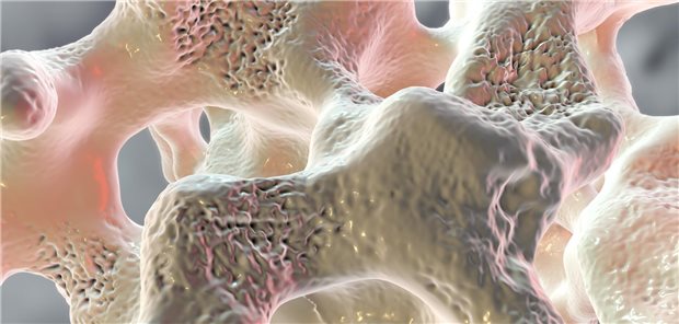 3D-Darstellung Knochenstruktur