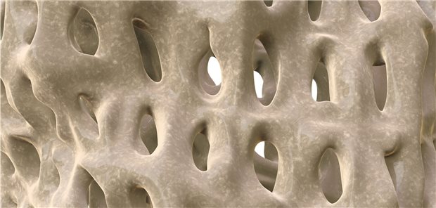 Osteoporose in einer 3D-Render-Makro-Aufnahme.