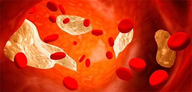 Outcomestudie soll 2017 den Zusatznutzen von Evolocumab belegen. Amgen kündigt an, das Produkt nicht vom Markt zu nehmen.