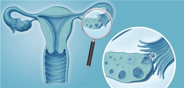 Wie die Verhütungsmethode die spätere Fruchtbarkeit beeinflusst Ovulation: Eine dauerhafte Beeinträchtigung der Fertilität durch Kontrazeptiva ist offenbar nicht zu befürchten, auch nicht bei Langzeitanwendung von hormonalen Kontrazeptiva.