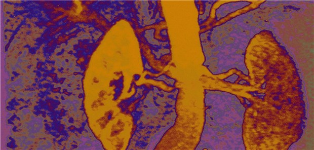 Oxalatkristalle lagern sich im Nierengewebe ab und fördern Entzündungsprozesse.