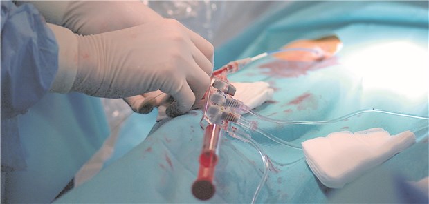 PCI: Ruft eine Koronarstenose nachweislich eine Ischämie hervor, sollte revaskularisiert werden.