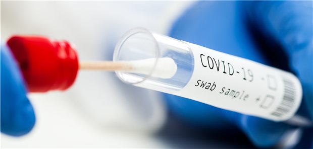 PCR-Test auf COVID-19: Testungen, die aus Anlässen vorgenommen werden, die von der Coronavirus-Testverordnung abgedeckt werden, werden nicht über den EBM abgerechnet.