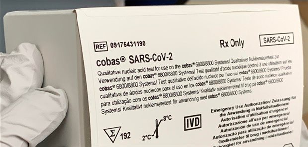 Corona-Diagnostik beschert Roche Deutschland zweistelligen Zuwachs PCR-Test für die Cobas®-Automaten. Die Mannheimer Diagnostika-Tochter profitierte erwartungsgemäß von der Nachfrage nach Corona-Analytik.