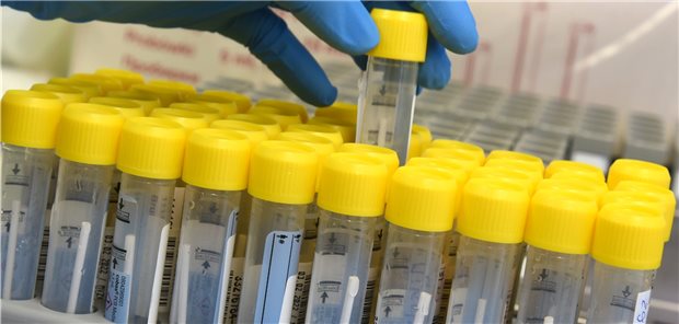 Laborärzte sind mit geplanter Corona-Testverordnung nicht rundum zufrieden PCR-Tests: Über eine aktuelle Auslastung von 93 Prozent berichten die Akkreditierten Labore in der Medizin.