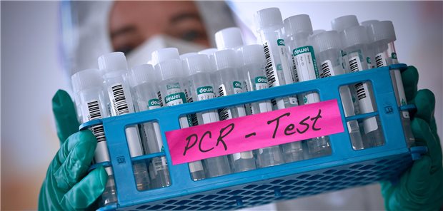 PCR-Tests gehen deutlich zurück. Zum Teil sei dies auf die Sommerferien zurückzuführen, wie der Berufsverband der Akkreditierten Labore in der Medizin mitteilt.
