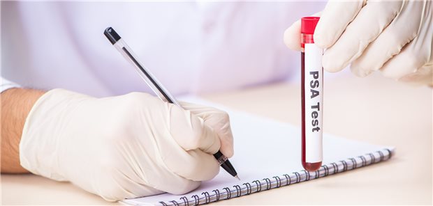 Urologen kritisieren GBA-Beschluss zum PSA-Screening PSA-Test: Die Deutsche Gesellschaft für Urologie sieht die Bestimmung als „unverzichtbaren Baustein“ bei der Früherkennung des Prostatakarzinoms.