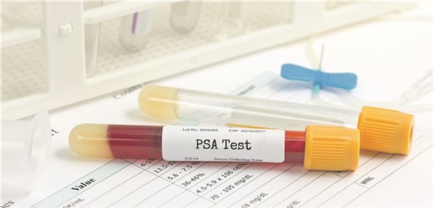 PSA-Test: Ist diese MIII-Leistung wirklich nur bei persönlicher Anwesenheit abrechenbar?