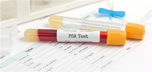 Früherkennung nicht ohne Risiken und Nebenwirkungen PSA-Test in der Praxis: Ein echtes Screening könnte zu Überversorgung führen.