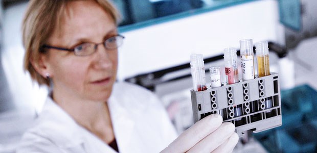 Zankapfel PSA-Test PSA-Wert-Bestimmung. Lohnt sich ein Screening zur Früherkennung des Prostatakarzinoms?