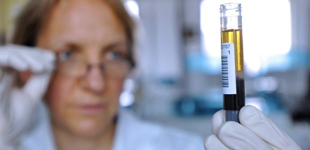 Macht der PSA-Test das Leben besser? PSA-Wert-Bestimmung: Was bringt er den QALYs?