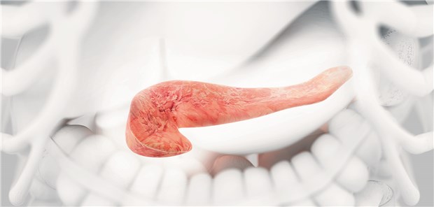 Pankreas: Fettgewebe, das sich in jüngeren Jahren angesammelt hat, könnte über einen längeren Zeitraum zur Karzinogenese beitragen.