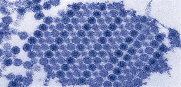 Chikungunya erobert die Welt Partikel des Chikungunya-Virus.