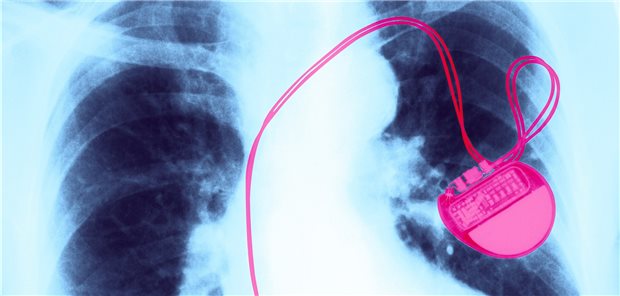 Patient mit Herzschrittmacher