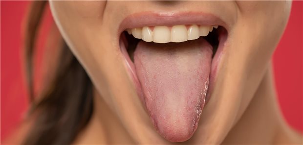 Was hinter Mundgeruch stecken kann Eine Frau streckt ihre Zunge heraus, man sieht ihre Zähne oben.