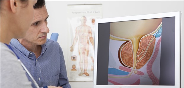 Patient mit Prostata-Ca: Welche Folgen hat eine Androgendeprivationstherapie?