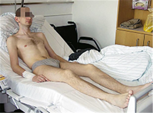 Kollaps im Sitzen durch Lewy-Körper-Syndrom Patient mit autonomer Polyneuropathie. Günstig ist hier eine Oberkörperhochlagerung.