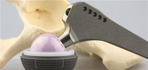 Künstliches Hüftgelenk