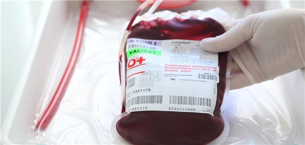 Patienten mit β-Thalassämie konnten ihre Bluttransfusionen rund einen Monat nach Exa-cel-Infusion beenden, und das für im Schnitt bislang 22,5 Monate. Das Hämoglobin stieg gleichermaßen bei Adoleszenten und Erwachsenen und unabhängig vom Genotyp an, auch bei der schwersten Form mit kompletten Fehlen von β-Globin-Ketten (β0/β0).