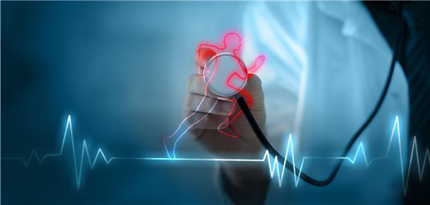 Belastungstest: Patienten mit KHK oder nach einem akuten Koronarsyndrom sollten mit dem Trainingsbeginn nicht lange warten.