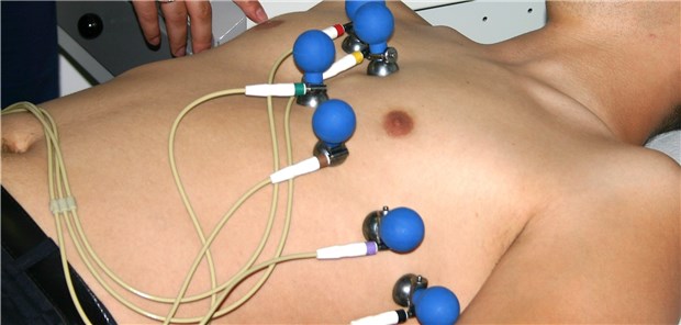 Patienten mit Vorhofflimmern benötigen häufig eine Koronarintervention.