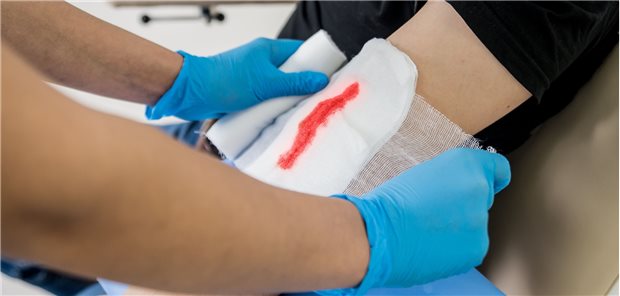 Notfallpatienten werden ambulant zunehmend von Niedergelassenen versorgt Patienten mit Wunden suchen häufig den Ärztlichen Bereitschaftsdienst auf statt in die Klinik zu fahren.