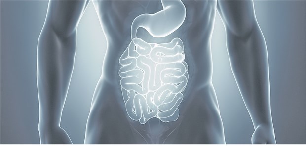 Patienten mit langstreckigem Dünn- und/oder Dickdarmbefall mit tiefen Ulzerationen haben wahrscheinlich einen komplizierten Verlauf.