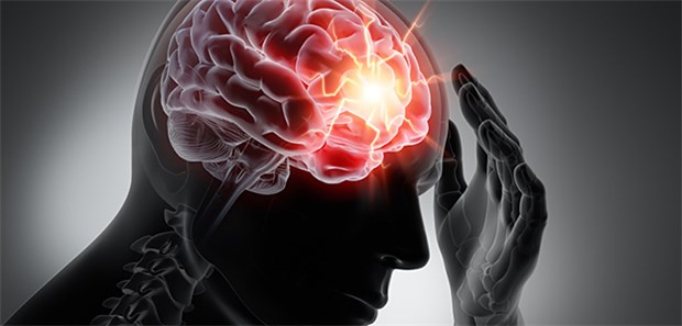Patienten mit wiederkehrenden Kopfschmerzen haben oft Angst, dass hinter ihren Beschwerden ein Hirntumor steckt.