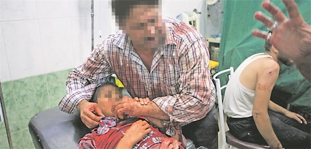 Hospitäler als Angriffsziele im syrischen Bürgerkrieg Patienten und Ärzte leiden: Grauenhafte Zustände herrschen oft in syrischen Kliniken – auch, wie hier, in Aleppo.