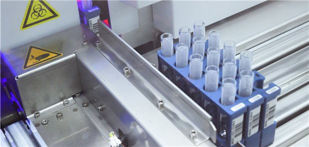 Patientenproben werden in einem Labor in einem Gerät für die molekulare Diagnostik zur Detektion von SARS-CoV-2 mittels PCR analysiert.