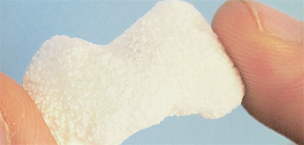 Lebendes Gewebe aus dem Drucker Per 3D-Druck hergestelltes individuelles Kahnbein aus Kalziumphosphat-Zement. Es wurde aus einem CT-Datensatz der Hand gefiltert und gedruckt.