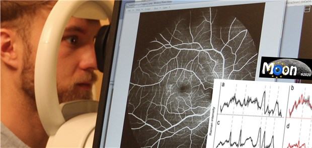 Per Augenscan können die Patienten ihr Auge berührungsfrei abrastern lassen und erhalten wenige Minuten später eine Diagnose.