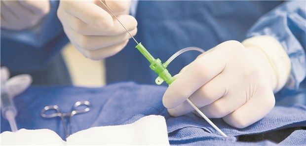 Perkutane Koronarintervention: Eine Revaskularisation ist auch angezeigt, wenn trotz optimierter Medikation Beschwerden fortbestehen und die Patienten den Eingriff wünschen.