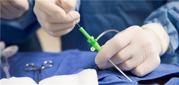 Perkutane Koronarintervention: Eine Revaskularisation ist bei Patienten mit stabiler KHK eine häufig genutzte Therapieoption.