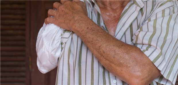 Phantomschmerzen nach Amputation