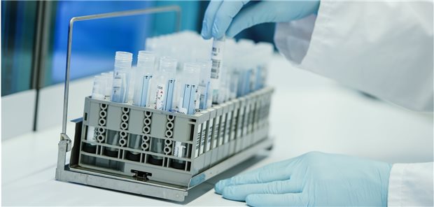 Pharmakogenetische Test werden in Deutschland von Speziallaboren durchgeführt (Symbolbild).