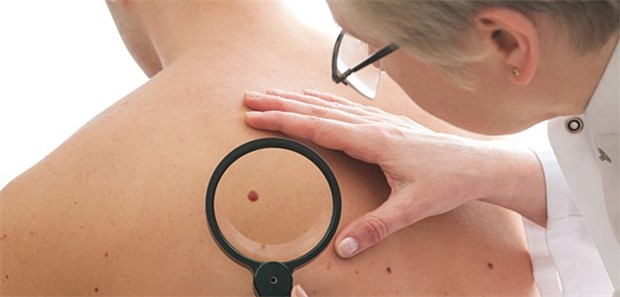 Lasertherapie mit bitteren Folgen Pigmentläsion: Mit Laser werden tieferliegende Melanozyten möglicherweise nicht erreicht; so dass Rezidive entstehen.