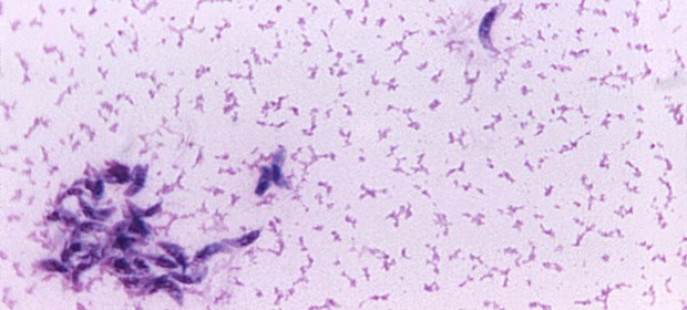 Vom Parasiten in den Suizid getrieben Plagegeist mit neurologischen Nebenwirkungen: Toxoplasma gondii